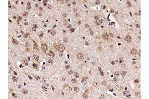 Paraformaldehyde-fixed, paraffin embedded mouse brain, Antigen retrieval by boiling in sodium citrate buffer (pH6) for 15min, Block endogenous peroxidase by 3% hydrogen peroxide for 30 minutes,  Blocking buffer (normal goat serum) at 37°C for 20min, Antibody incubation with RPS6 Polyclonal Antibody (bs-3565R) at 1:400 overnight at 4°C, followed by a conjugated secondary and DAB staining.