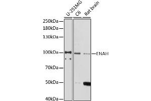 Western blot analysis of extracts of various cell lines, using ENAH antibody (ABIN7266936) at 1:1000 dilution. (ENAH anticorps  (AA 412-591))