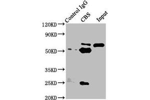 Immunoprecipitating CBS in Hela whole cell lysate Lane 1: Rabbit control IgG instead of ABIN7148965 in Hela whole cell lysate. (CBS anticorps  (AA 1-413))