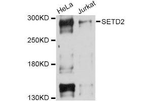 Western blot analysis of extracts of various cell lines, using SETD2 Antibody. (SETD2 anticorps  (AA 803-1103))