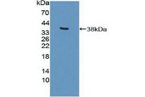 Detection of Recombinant EP300, Human using Polyclonal Antibody to E1A Binding Protein P300 (EP300) (p300 anticorps  (AA 1351-1601))
