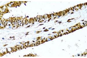 Immunohistochemistry of paraffin-embedded Human breast using NFkB p100 / p52 Polyclonal Antibody at dilution of 1:100 (40x lens). (NFKB2 anticorps)