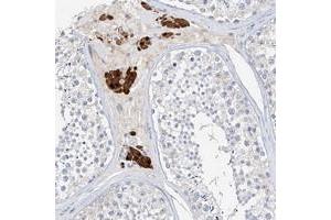 Immunohistochemical staining of human testis with ZZEF1 polyclonal antibody  shows strong cytoplasmic and nuclear positivity in cells of seminiferus ducts. (ZZEF1 anticorps)