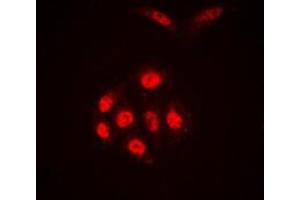 Immunofluorescent analysis of SAE1 staining in A431 cells.