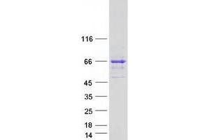 Validation with Western Blot