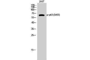 Western Blotting (WB) image for anti-T-Complex 1 (TCP1) (pSer455) antibody (ABIN3182583) (TCP1 alpha/CCTA anticorps  (pSer455))