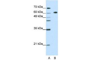 WB Suggested Anti-GMEB2  Antibody Titration: 1.