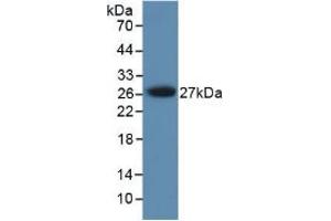 Figure. (PRSS1 anticorps  (AA 51-228))
