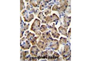 BTC Antibody (N-term) immunohistochemistry analysis in formalin fixed and paraffin embedded human pancreas tissue followed by peroxidase conjugation of the secondary antibody and DAB staining. (Betacellulin anticorps  (N-Term))