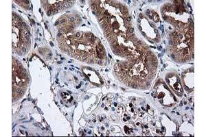 Immunohistochemical staining of paraffin-embedded Human Kidney tissue using anti-CAT mouse monoclonal antibody. (Catalase anticorps)