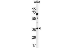 ALDOC Antibody (N-term) western blot analysis in WiDr cell line lysates (35 µg/lane). (ALDOC anticorps  (N-Term))