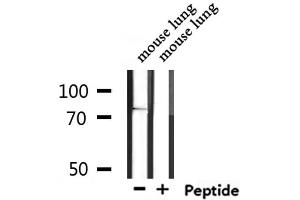 Western blot analysis of extracts from mouse lung, using SV2C Antibody.