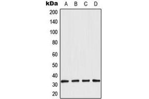 Western blot analysis of Aquaporin 3 expression in LOVO (A), A431 (B), NIH3T3 (C), rat kidney (D) whole cell lysates. (AQP3 anticorps  (Center))