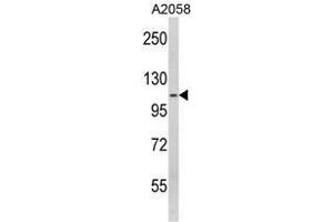 Western blot analysis of SPINK5 Antibody (N-term) in A2058 cell line lysates (35ug/lane). (SPINK5 anticorps  (N-Term))