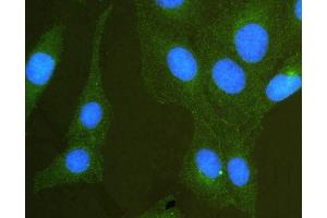 anti-Scribbled Homolog (SCRIB) (AA 172-409) antibody