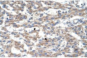 Human Heart (Deoxyuridine Triphosphatase (DUT) (C-Term) anticorps)