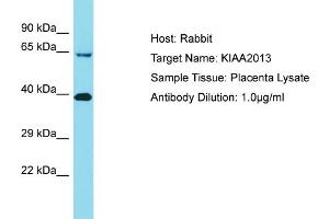 Host: Rabbit Target Name: KIAA2013 Sample Tissue: Human Placenta Antibody Dilution: 1ug/ml (KIAA2013 anticorps  (C-Term))