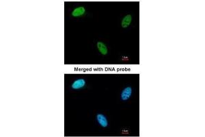 ICC/IF Image Immunofluorescence analysis of paraformaldehyde-fixed HeLa, using Deoxycytidine kinase, antibody at 1:200 dilution.