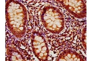 IHC image of ABIN7160120 diluted at 1:1200 and staining in paraffin-embedded human appendix tissue performed on a Leica BondTM system. (MOBKL1A anticorps  (AA 2-216))