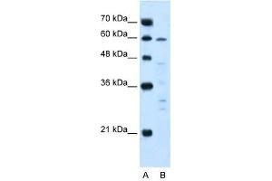 IL10R Alpha antibody used at 5 ug/ml to detect target protein. (IL-10RA anticorps  (N-Term))