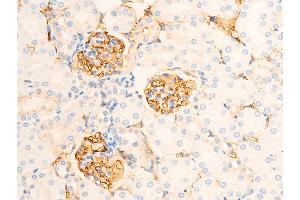 ABIN6267219 at 1/100 staining mouse kidney tissue sections by IHC-P.