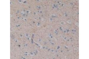 Detection of SP in Human Brain Tissue using Polyclonal Antibody to Substance P (SP) (Substance P anticorps)
