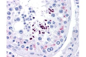 Immunohistochemistry (IHC) image for anti-Cyclin D1 (CCND1) (N-Term) antibody (ABIN2777893)