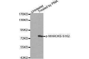 Western blot analysis of extracts from 293 cells, using Phospho-MARCKS-S162 antibody.
