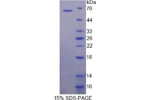 SDS-PAGE of Protein Standard from the Kit (Highly purified E. (ATG16L1 Kit ELISA)