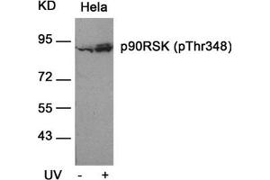 Western blot analysis of extracts from Hela cells untreated or treated with UV using p90RSK(Phospho-Thr348) Antibody. (RPS6KA1 anticorps  (pThr348))