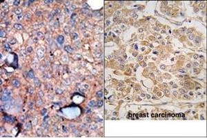 Image no. 2 for anti-Inhibitor of kappa Light Polypeptide Gene Enhancer in B-Cells, Kinase epsilon (IKBKE) (C-Term) antibody (ABIN360635)