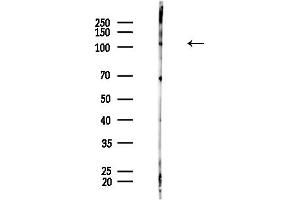 anti-Cylindromatosis (Turban Tumor Syndrome) (CYLD) (C-Term) antibody