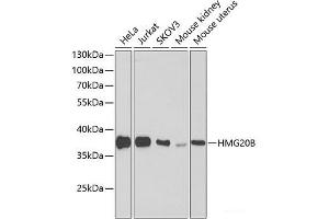 Western blot analysis of extracts of various cell lines using HMG20B Polyclonal Antibody at dilution of 1:1000. (HMG20B anticorps)