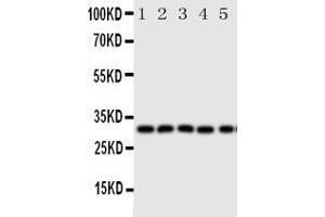 Anti-Aquaporin 9 antibody, Western blottingAll lanes: Anti Aquaporin 9  at 0. (AQP9 anticorps  (C-Term))