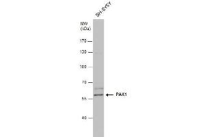WB Image PAK1 antibody detects PAK1 protein by western blot analysis. (PAK1 anticorps  (Center))