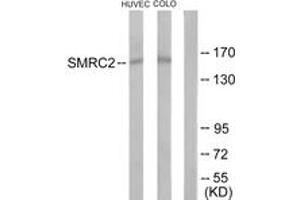 Western blot analysis of extracts from HuvEc/COLO205 cells, using SMRC2 Antibody. (SMARCC2 anticorps  (AA 361-410))