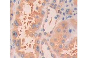 IHC-P analysis of Human Tissue, with DAB staining. (CCL14 anticorps  (AA 20-93))