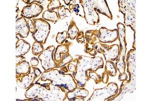 IHC analysis of TANK using anti-TANK antibody (ABIN6719508). (TANK anticorps)