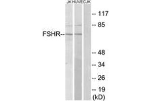Western blot analysis of extracts from Jurkat/HuvEc cells, using FSHR Antibody. (FSHR anticorps  (AA 211-260))