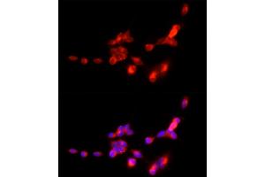 Immunofluorescence analysis of SH-SY5Y cells using SLC17 Rabbit pAb (ABIN6127303, ABIN6147863, ABIN6147864 and ABIN6216671) at dilution of 1:250 (40x lens). (SLC17A7 anticorps  (AA 461-560))