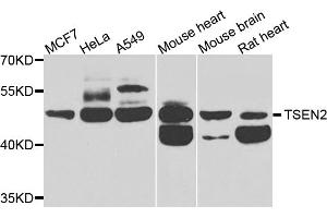 Western blot analysis of extracts of various cell lines, using TSEN2 antibody. (TSEN2 anticorps)