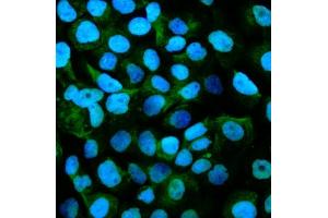 IF analysis of Gpnmb using anti-Gpnmb antibody (ABIN7600217). (Osteoactivin anticorps  (AA 164-564))