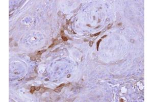 IHC-P Image Immunohistochemical analysis of paraffin-embedded Cal27 xenograft, using AID, antibody at 1:500 dilution.