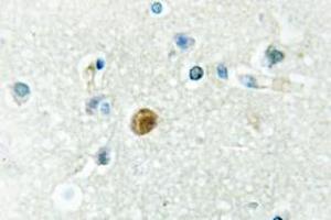 Image no. 1 for anti-Interferon Regulatory Factor 3 (IRF3) antibody (ABIN317879) (IRF3 anticorps)