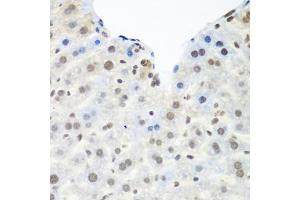 Immunohistochemistry of paraffin-embedded mouse liver using TARDBP antibody. (TARDBP anticorps)