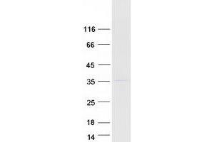 Validation with Western Blot