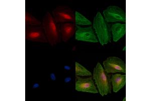 ABIN6257054 and ABIN6274619 staining  cells by IF/ICC. (CDK5RAP3 anticorps)