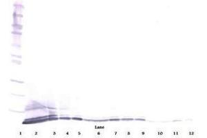 Image no. 4 for anti-Chemokine (C-X-C Motif) Ligand 5 (CXCL5) antibody (ABIN465535)