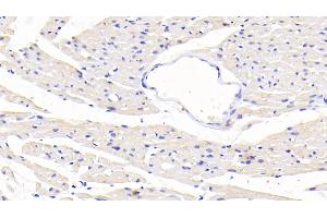 Detection of SLC in Rat Cardiac Muscle Tissue using Polyclonal Antibody to Secondary Lymphoid Tissue Chemokine (SLC)
