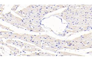 Detection of SLC in Rat Cardiac Muscle Tissue using Polyclonal Antibody to Secondary Lymphoid Tissue Chemokine (SLC) (CCL21 anticorps  (AA 5-132))